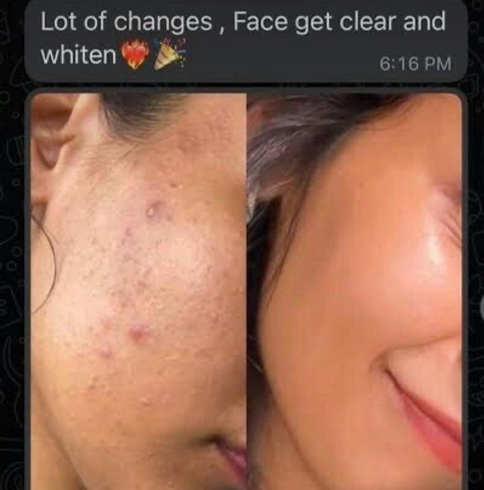 Skin D-Tan Whitening Soap