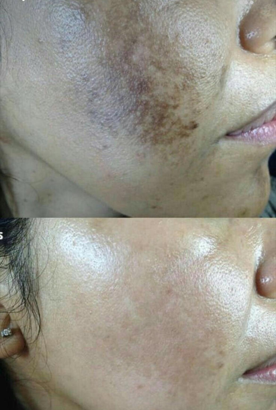 Skin D-Tan Whitening Soap
